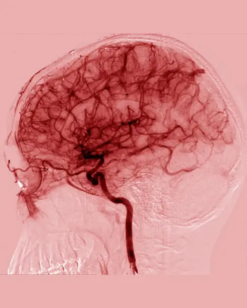 Brain Blood Flow