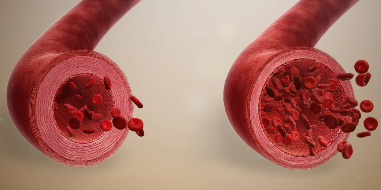 Nitric Oxide Vasodilation