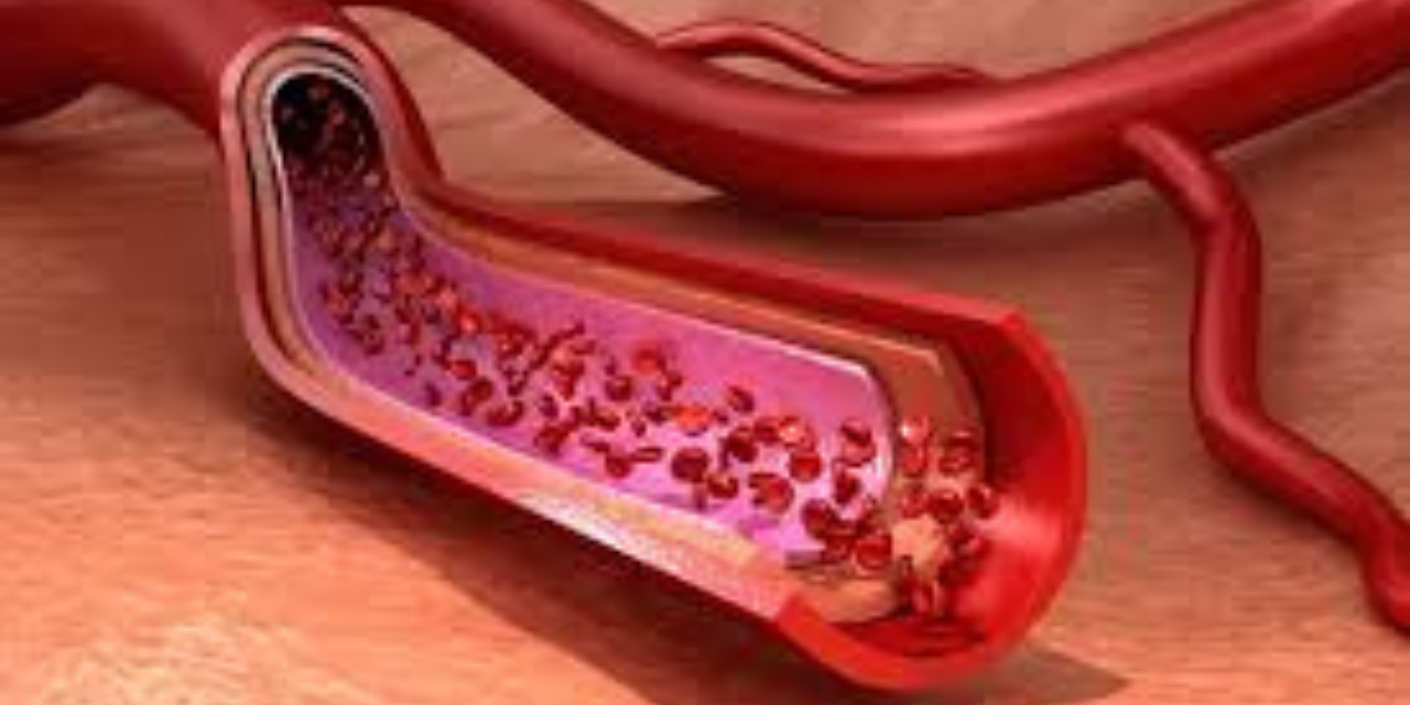 Vascular Endothelium Health