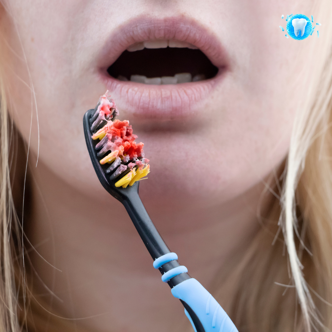 Stops Bleeding Gums in Days