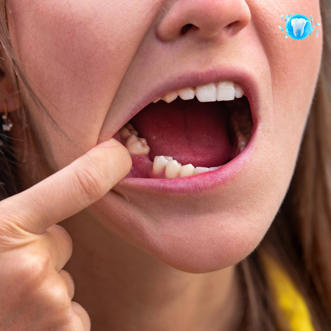 Strengthens Loose Teeth